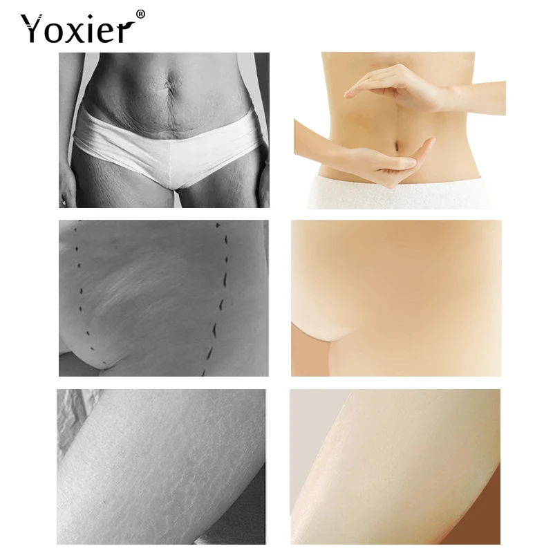 3 шт. крем для похудения и уменьшения целлюлита Yoxier|Автозагары бронзаторы тела| |