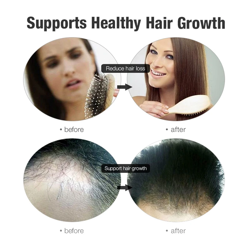 PURC-30-Days-Hair-Growth-Spray-Strengthen-Hair-Essence-Liquid-Fast-Grow-Restoration-Dense-Thicker-Anti