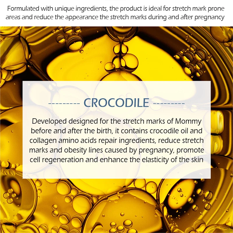 VIBRANT GLAMOUR 30g Crocodile Stretch Marks Remover Cream Pregnancy Scars Ance Maternity Repair Anti Aging Winkles Firming