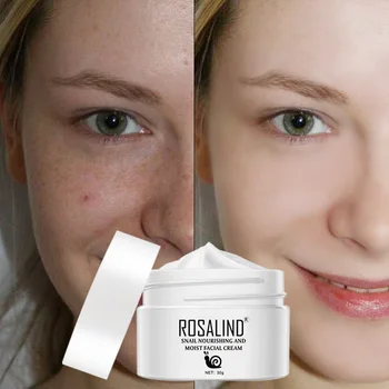 

Snail Cream Moisturizes Replenishes Pure Anti-sensitive Cream EY669