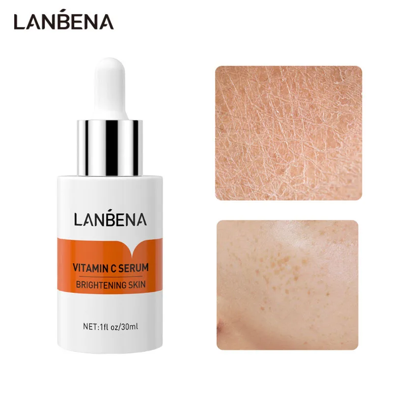 

LANBENA Vitamin C Whitening Serum Brighten Anti Oxidation Remove Freckle Anti Wrinkle Improve Dull Skin Moisturizer Skin Care
