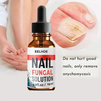 

10/20/30Ml Nail Repair Liquid Treatment Remove Onychomycosis Nail Essence Anti Remove Nail Onychomycosis Fungus Toe Nail Care