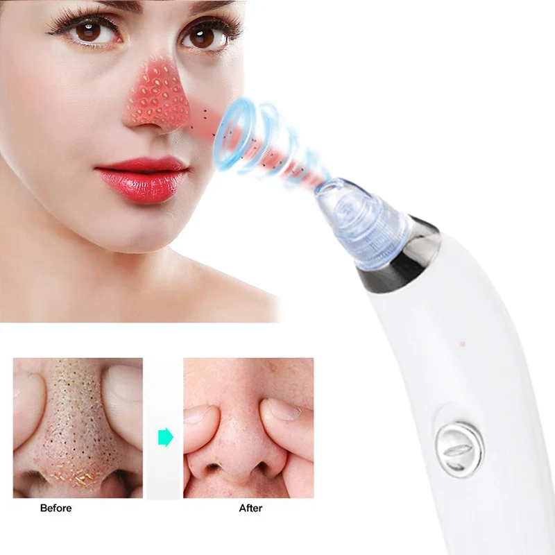 Professional Blackhead Vacuum Acne Cleaner Pore Remover Inhaler Spot Facial Cleaning Remover Face Care Beauty DeviceTools
