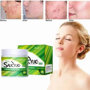 

55pcs Salicylic Acid Oil Control Cotton Sheet Acne Cleansing Mask To Reduce Acne Closed Mouth Acne Shrink Pores Skin Care