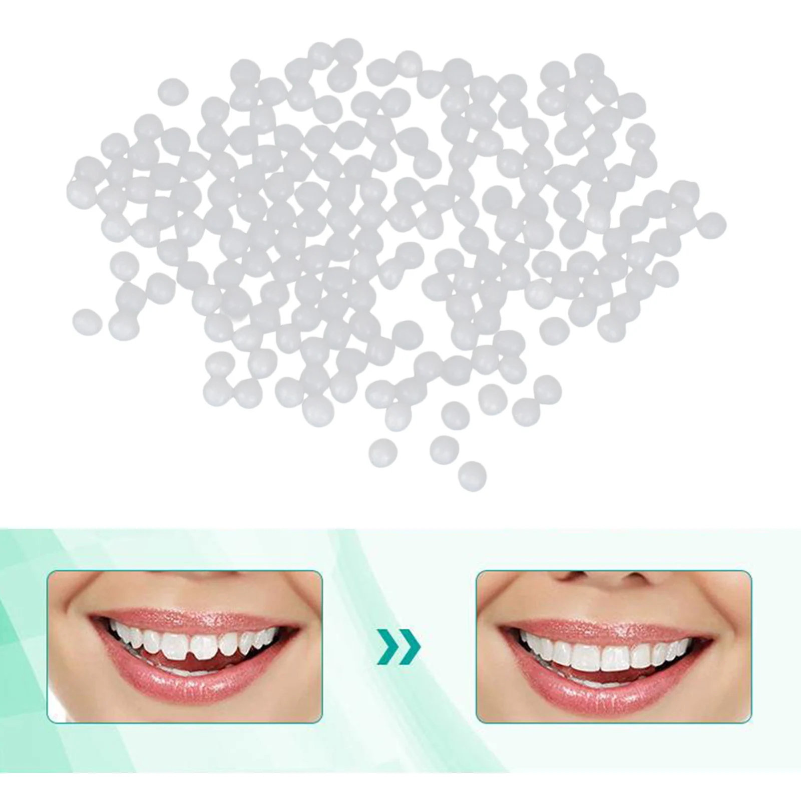 Thermal Beads Repair Granules Teeth Veneers Moldable for Big Gaps -  AliExpress