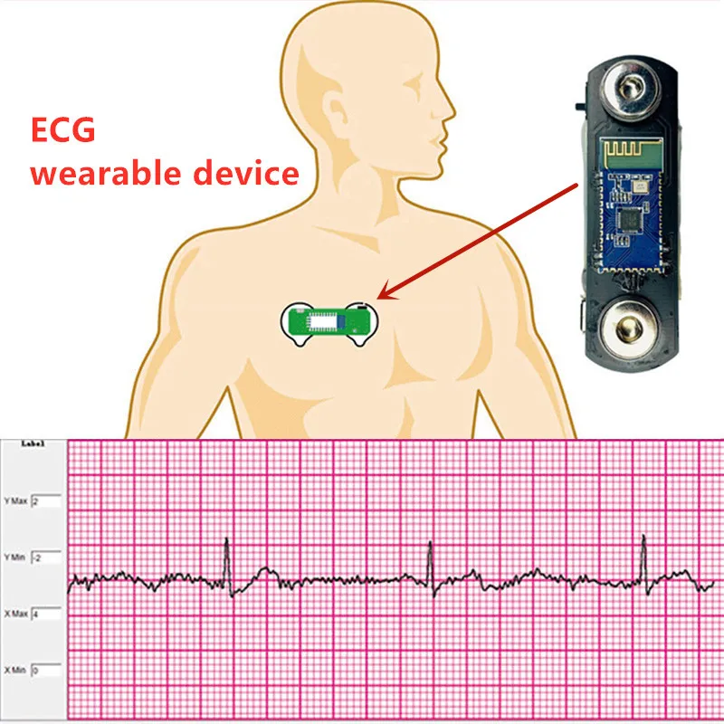 BMD101 ECG Sensor ECG Module ECG Sensor Kit Heart Rate HRV Chest