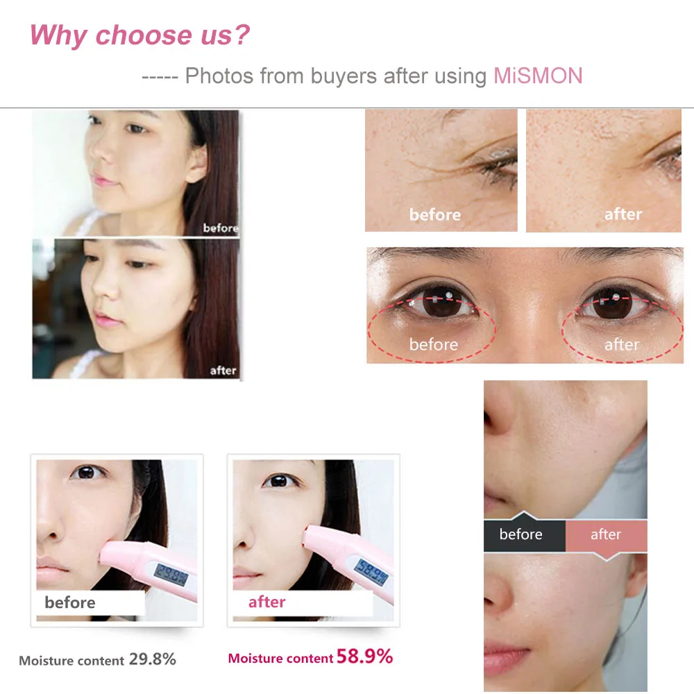 - MISMON 306C Radio Frequency Beauty Devices Skin Care RF Lifting Machine EMS LED Photon Rejuvenation Massager for Face Home Spa