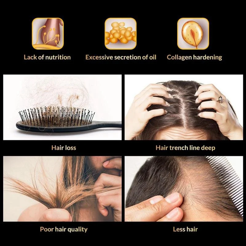Новое поступление, 30 мл, имбирное масло, эссенция для роста волос, жидкость для быстрого роста волос, естественное лечение выпадения волос, уход за волосами