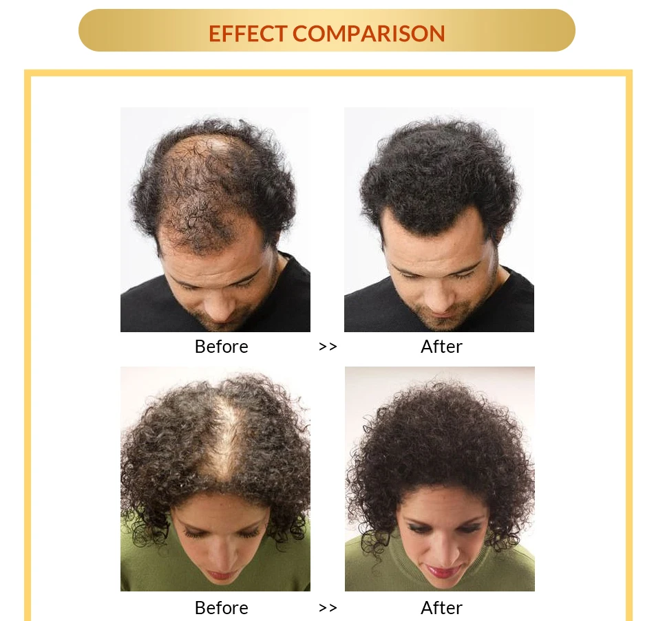 HTB1N5LraYys3KVjSZFnq6xFzpXan