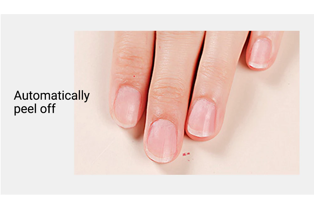 remover gel7