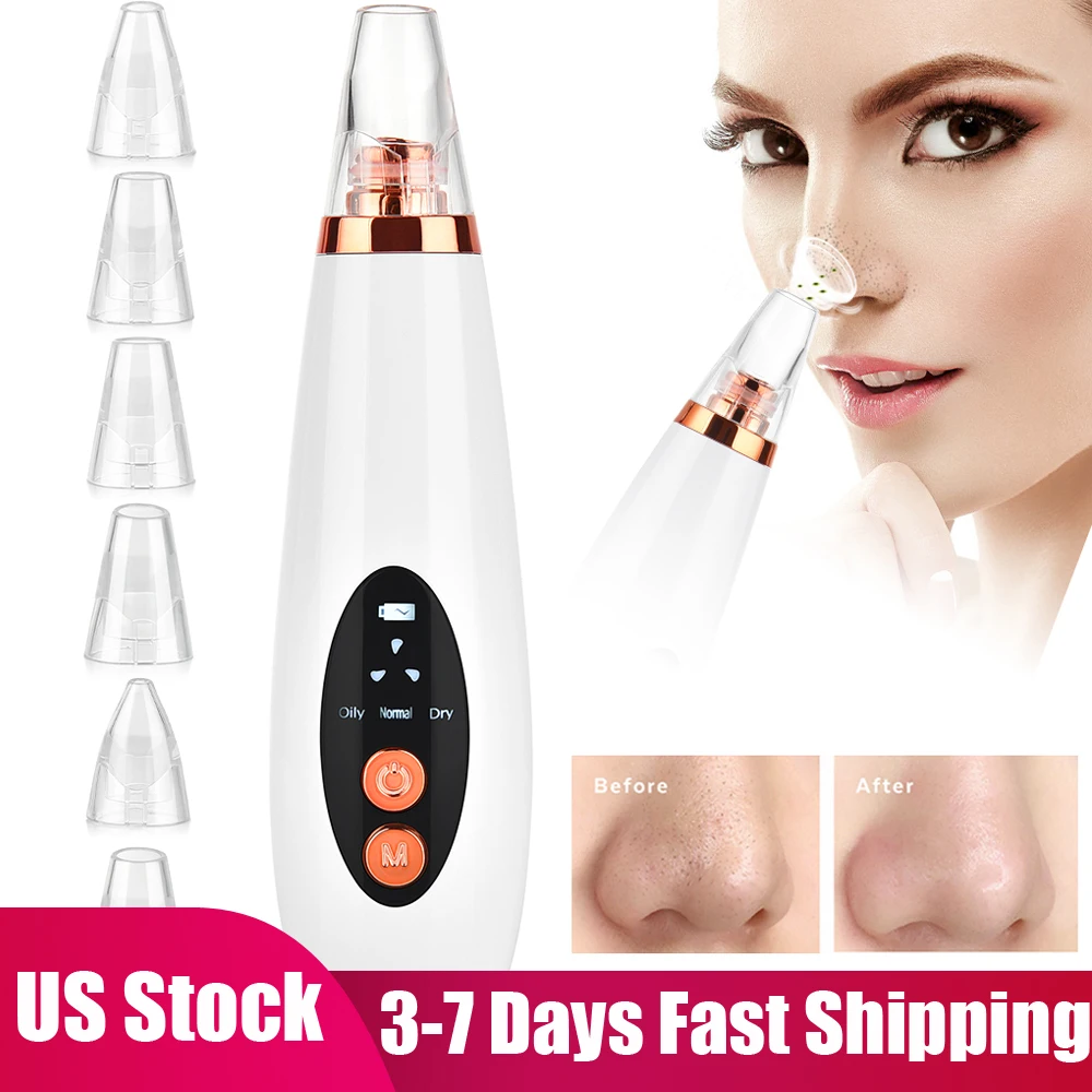 Electric Blackhead Remover Vacuum Suction Face Deep Pore Cleaner Pimple Acne Extractor Facial Beauty Care Tool | Красота и здоровье