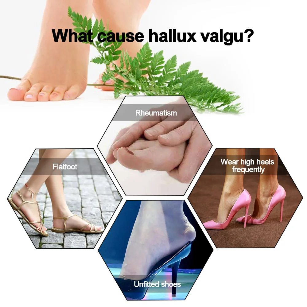 1 пара больших пальцев Bunion Hallux вальгусный ортопедический носок разделители для ног облегчение боли инструмент для ухода за ногами