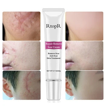 

RtopR Skin Repair Face Cream Acne Scar Stretch Mark Repair Cream Treatment Blackhead Whitening Cream Moisturizer AcneCream TSLM1