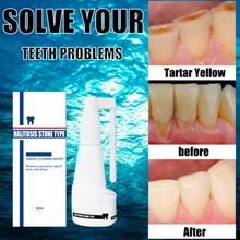 

Dental Calculus Cleaning Halitosis Stone Type Remove Water Teeth Smell And Peculiar Dental Calculus Cleaning Whitening