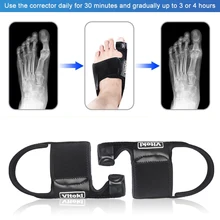 Протектор корректор пальцев ног сепараторы буйон уход гель подушки Pad облегчение боли, бурсит больщого пальца стопы Корректор для женщин