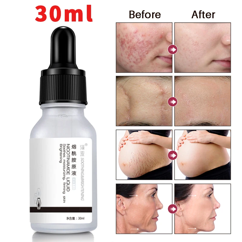 

30ml Natural 5% Niacinamide Pore Treatment Serum Skin Anti-Wrinkle Repair Face Care Hydrating Brighten Skin Pore Repair Essence