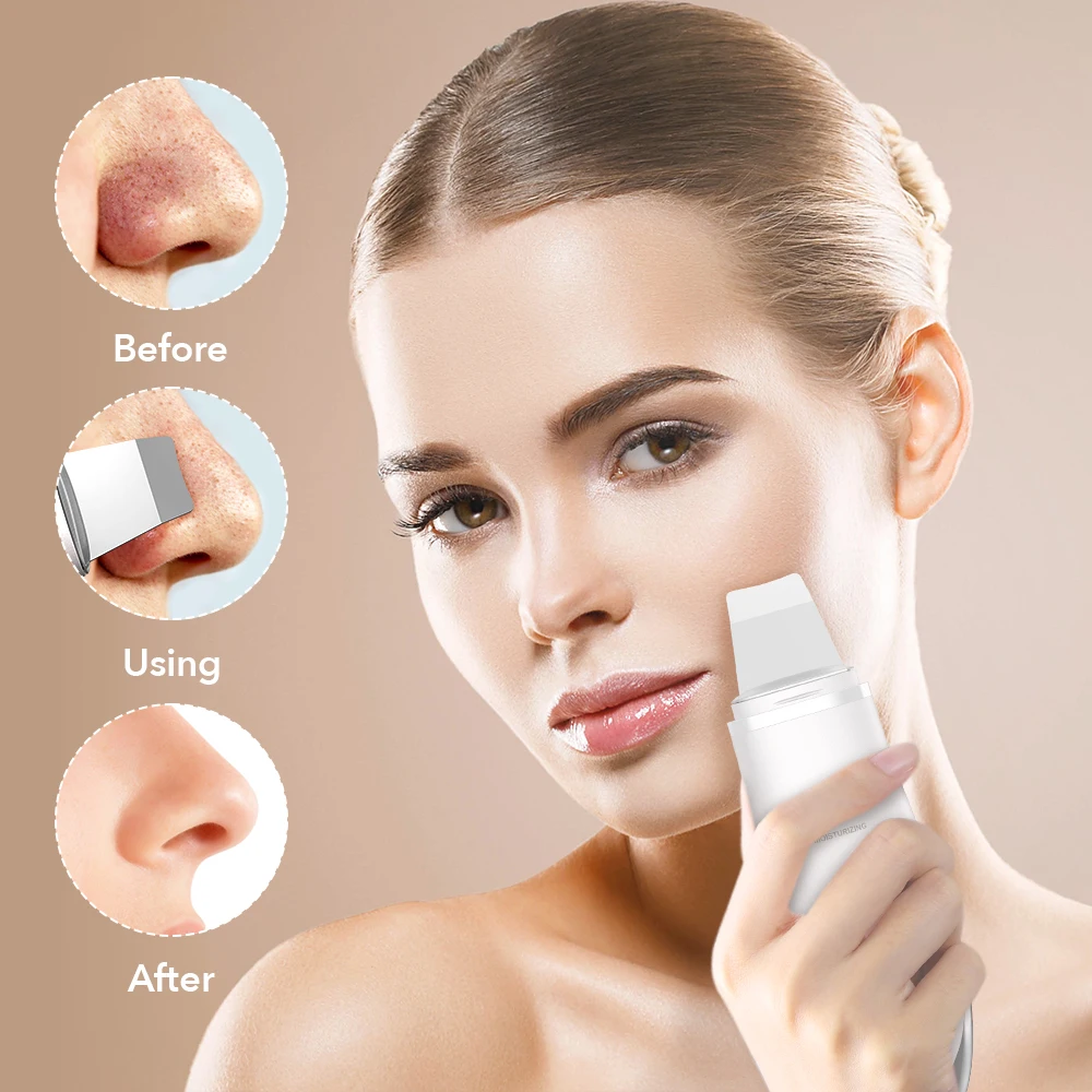 

Ultrasonic Skin Scrubber Facial Cleansing Exfoliator Machine Massager Deep Face Cleaning Pore Cleaner Beauty Instrument
