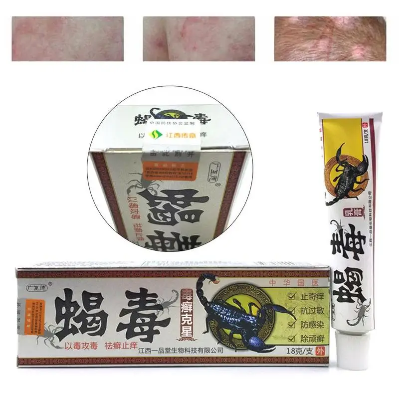 1 pcs Scorpion venom antibacterial cream Psoriasis Anti Itching Massage Cream Skin Care Health Tool | Красота и здоровье