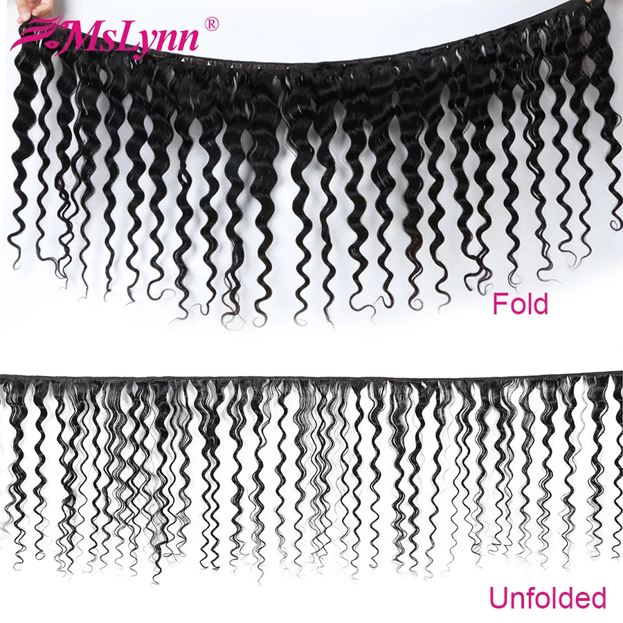 bundle deals with frontal