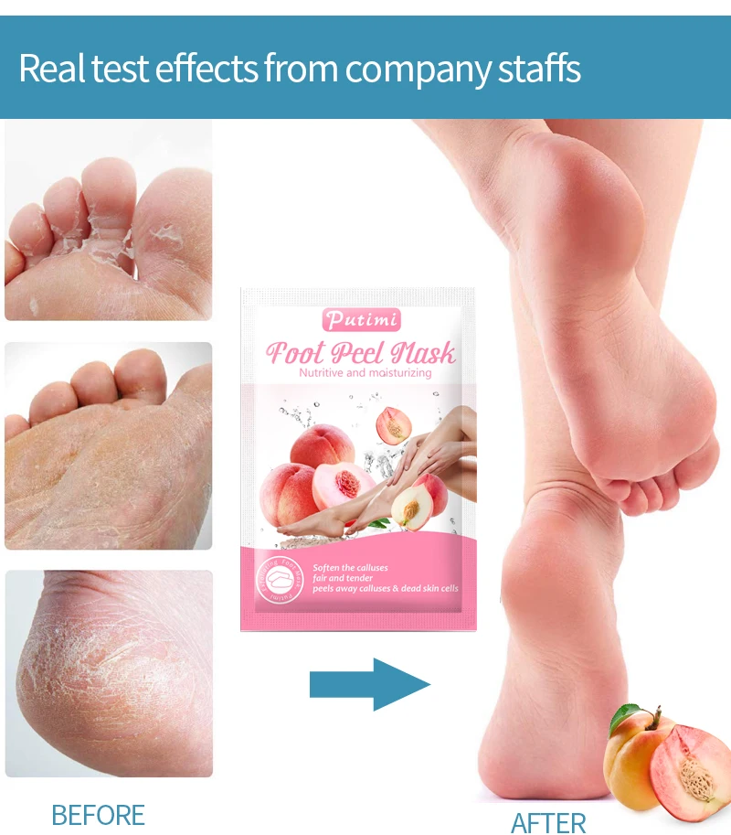 Hff7be5f58ecd495aa505f4e2601b93f31 Putimi Peach Feet Mask Remove Dead Skin Cuticles Heels Socks for Pedicure Exfoliating Foot Mask Foot Peeling Mask Foot Care