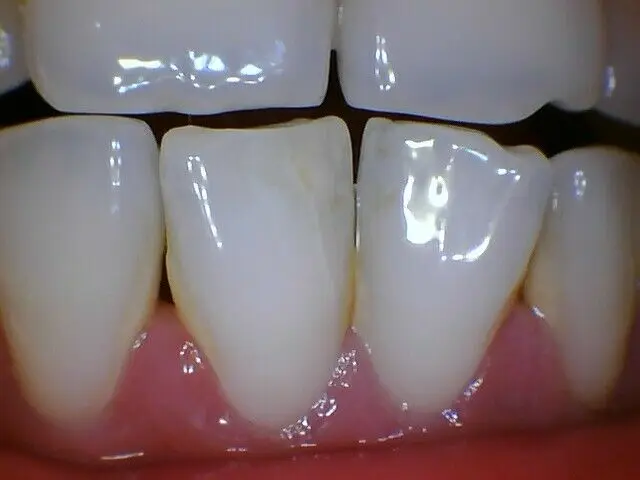  New Dental Touch screen capacitive monitor with intraoral camera built in Intel/Windows10