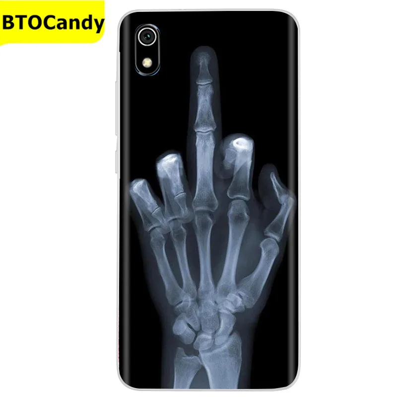 Phone Case For Xiaomi Redmi 7A Case Soft Tpu Cover Redmi7a 7 a Silicone Back Case For Xiomi Xiaomi Redmi 7A Case Coque Fundas iphone waterproof bag Cases & Covers