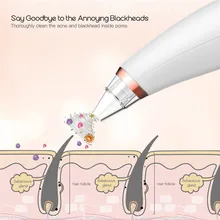 CkeyiN средство для удаления угрей лицо поры очиститель прыщей Удаление прыщей Электрический вакуум Очищение лица спа красота уход за кожей Инструменты