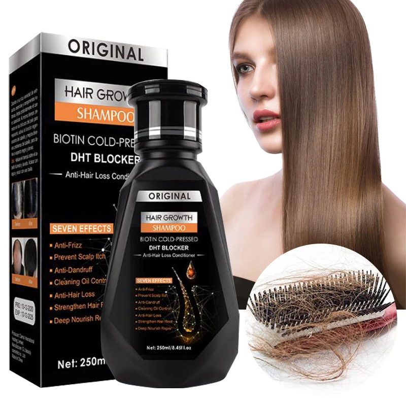 Hair Care Hair Growth Shampoo Essential Oil Anti-dandruff Hair Loss Fast  Powerful Repair Hair Smooth Ginger Scalp Treatment 1pcs - Hair & Scalp  Treatments - AliExpress
