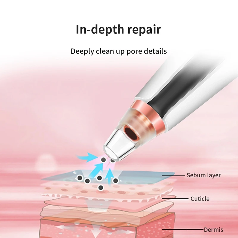 USB зарядка пылесос для лица Уход за кожей машина удаления черных точек Прыщи