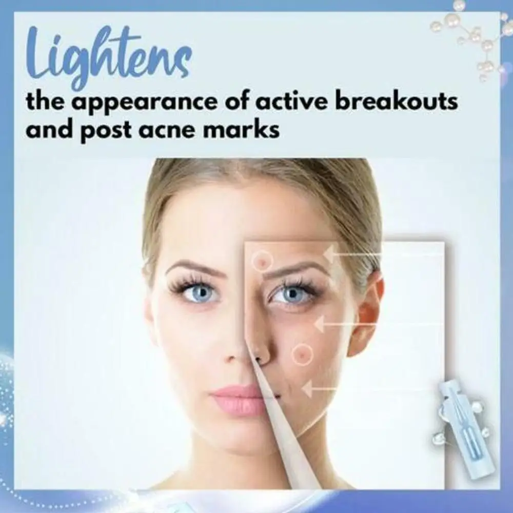 1 компл. корректор кожи Ampoule-30pcs/коробка темные пятна для лица веснушки удаление Антивозрастная сыворотка