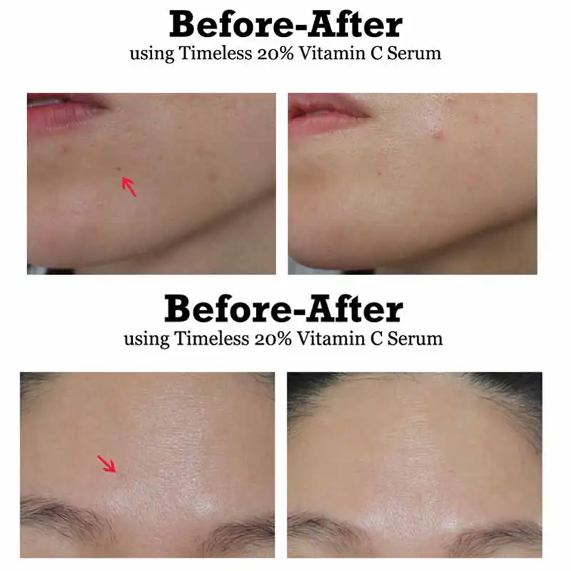 vitamin e ferulic acid serum