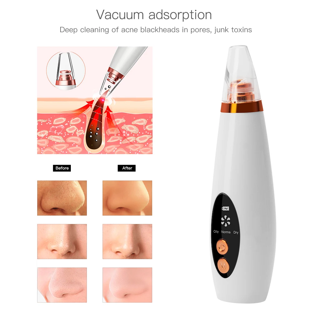 Blackhead Remover Face Deep Cleaner Pore Acne Pimple Removal Vacuum Suction Facial Diamond Beauty Cleansing Skin Care Machine