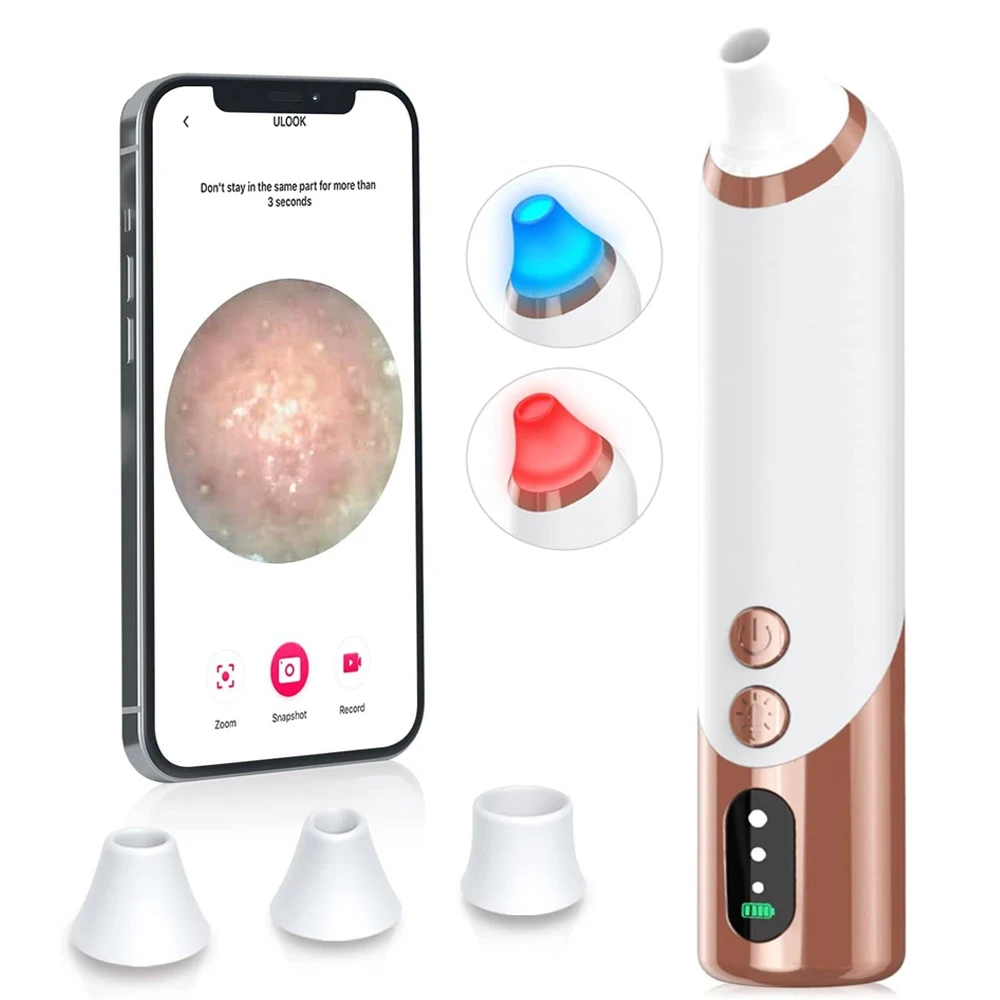 1080PHDWirelessVisualBlackheadRemoverVacuumFaceAcnePore