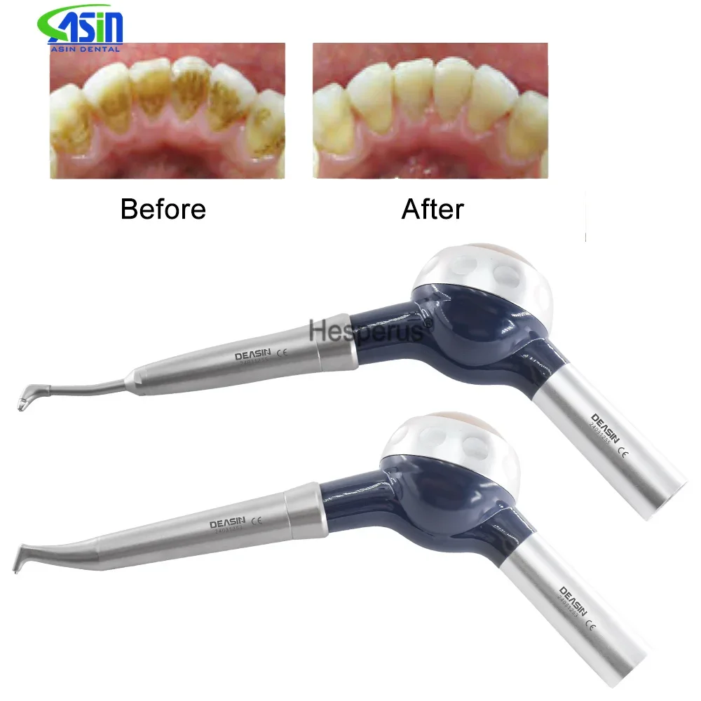 Zähne Bleaching Spray Dental Luft Wasser Polierer Fit für KAVO Koppler Mundhygiene airFlow Sandstrahlen Polierer Zahnmedizin Werkzeug
