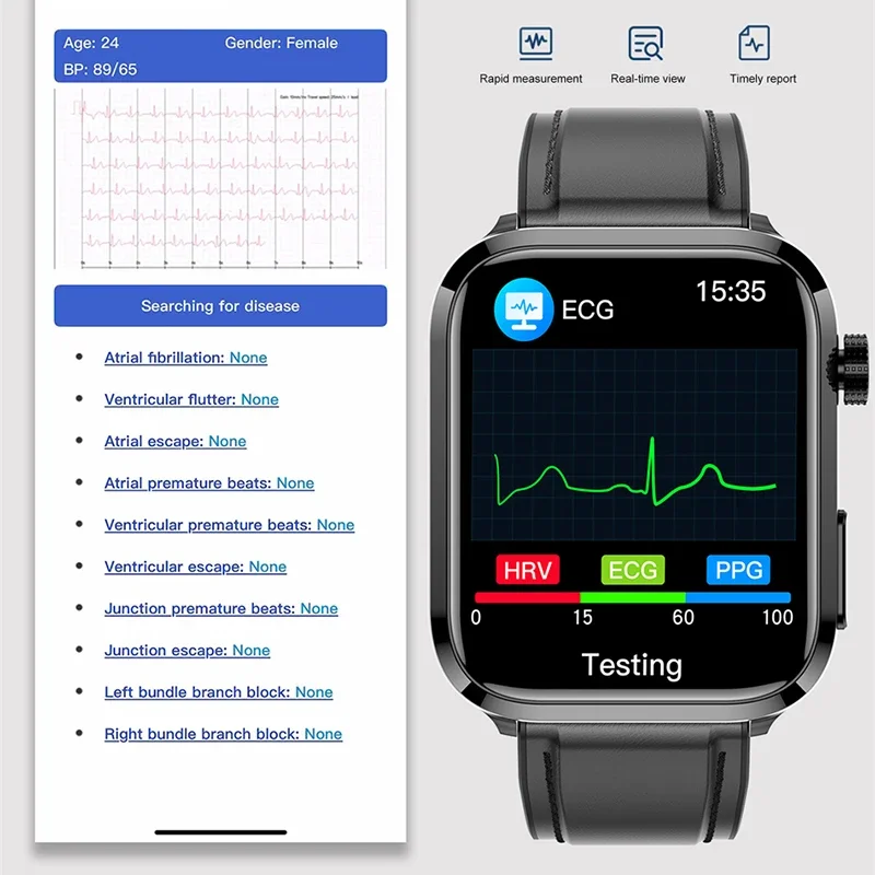      Ʈ ġ, ECG + PPG ƮϽ ƮĿ ð, ɹڼ  ȭ Ʈġ, 2024 ǰ
