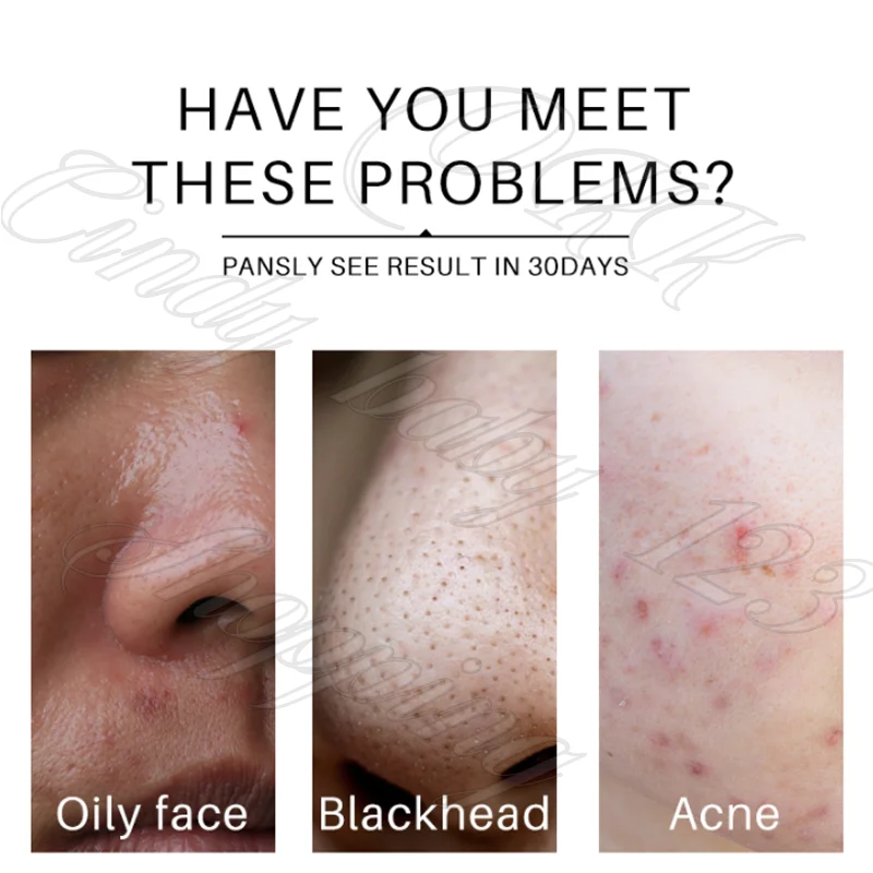 Amino Acid Double Tube Oil Control Moisturizing Cleanser Gentle Cleansing Shrink Pore Improvement Problem Skin Cleanser 5