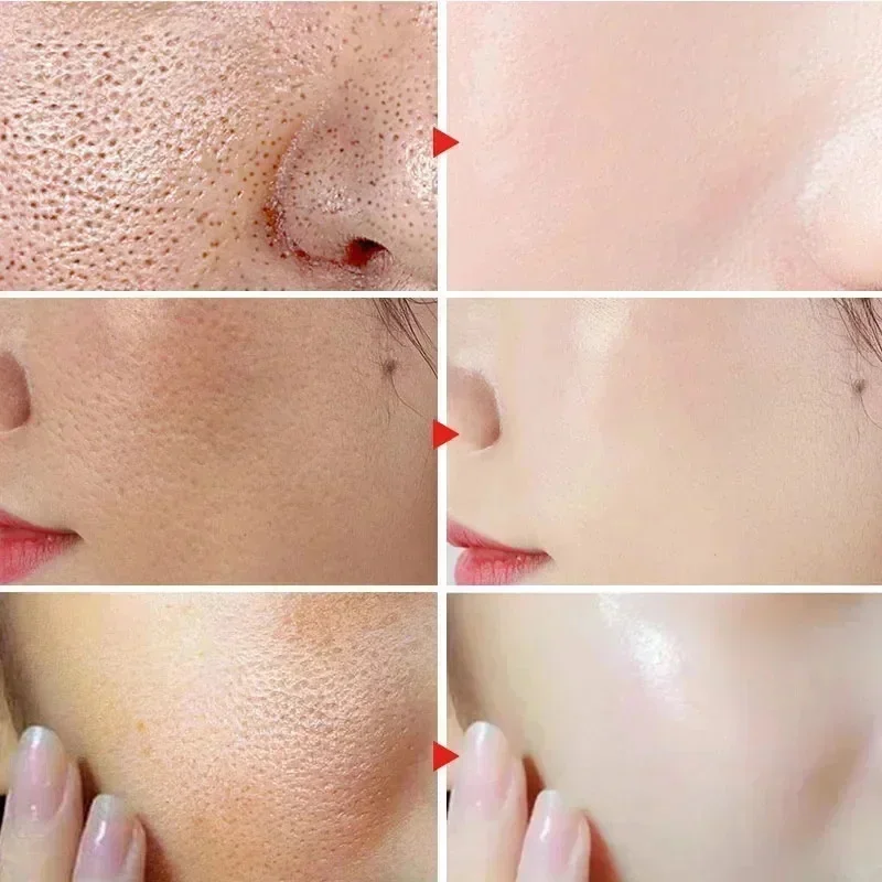 Remove Large Pores Serum Lactic Acid Facial Pore Shrinking Repairing Products Pore Minimizing Firming Smooth Korean Skin Care 2