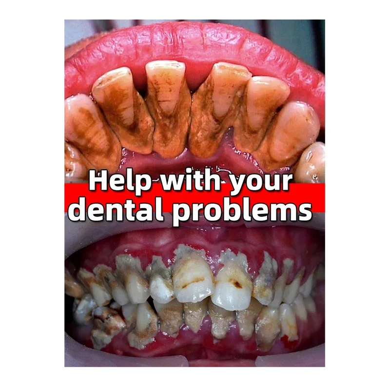 Dental Calculus Remover Toothpaste Wipe Off Plaque Stain Herbal Fresh Breath Teeth Whitening 100g