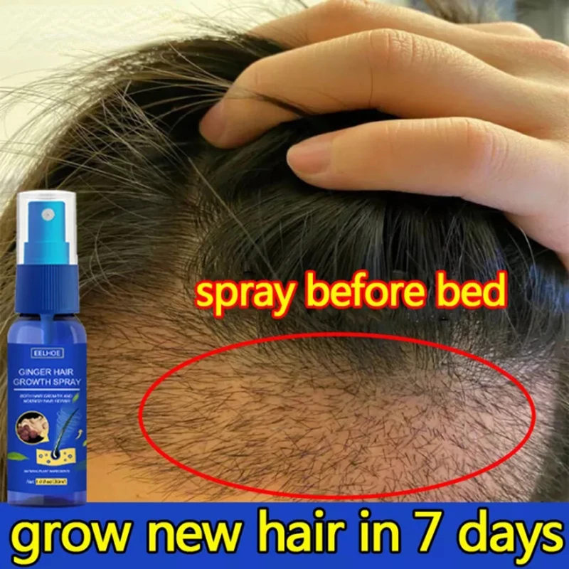 Hair Growth Spray 30ml Ginger Extract Prevent Baldness Moisturize Scalp Anti Hair Loss Treatment