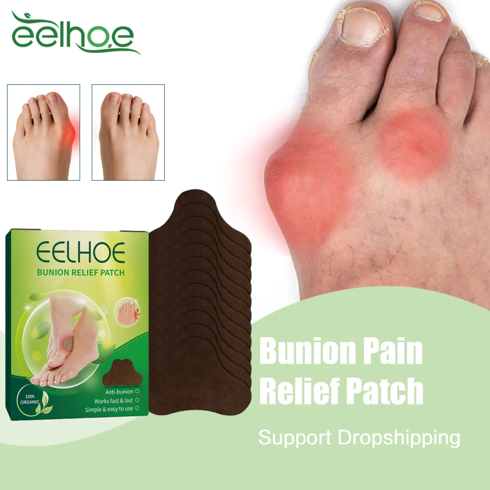Bunion Analgesic Patch Correct Thumb Joint Gout Treatment Toe Swell Relief Anti Inflammation Hallux Valgus Orthopedic Sticker