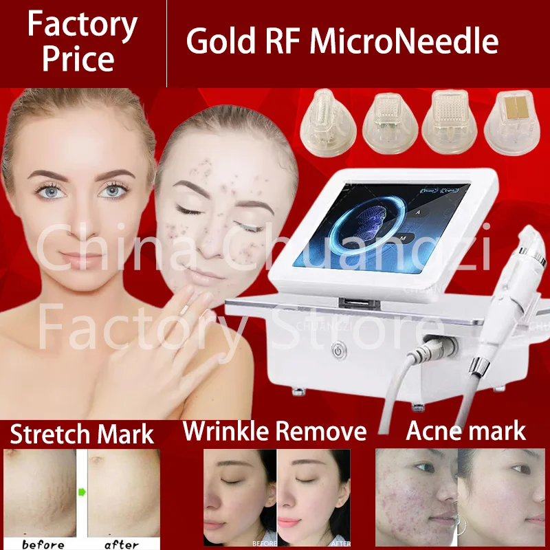 

Whitening Fractional RF Frequency Micro Beauty Machine For Stretch Mark Scar Acne Remove Face Lifting Body Treatment