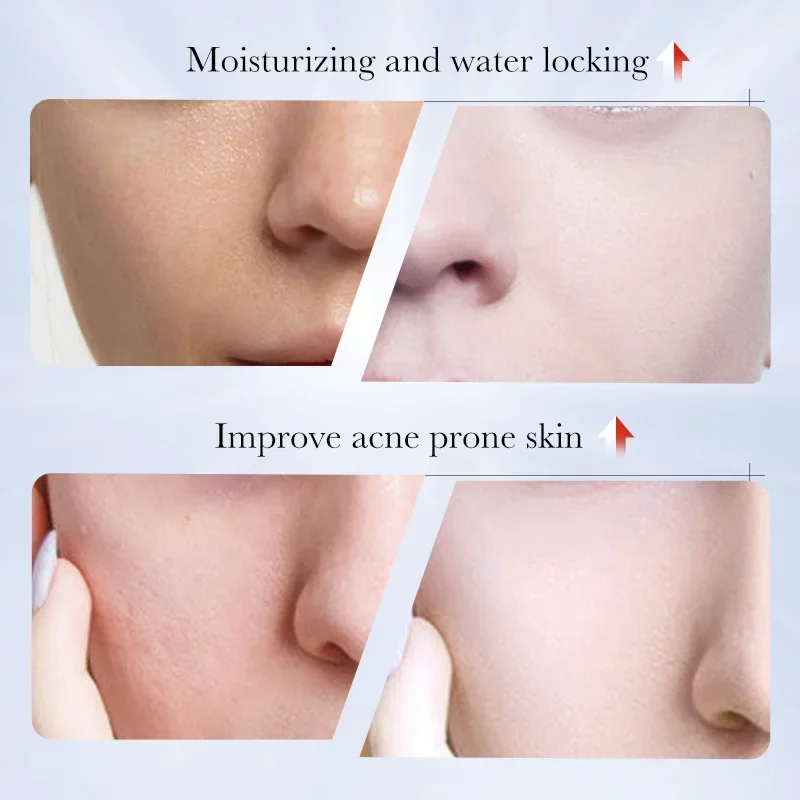 100ml Kojic Acid Skin Care Facial Wash Mild Oil Control Deep Moisturizing Cleansing and Nonirritating Face Cleanser Face Wash 3