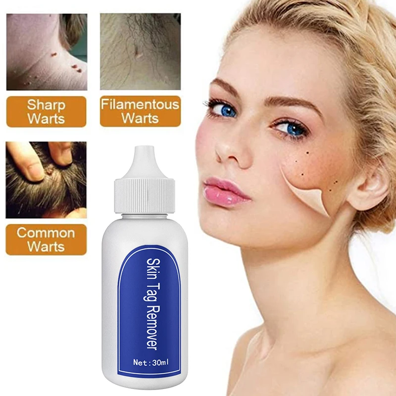 

30ml Skin Tag Remover Pen Against Mole Genital Wart fast Remover Removal Papillomas Rapidly Removes Mole Anti Foot Corn Liquid