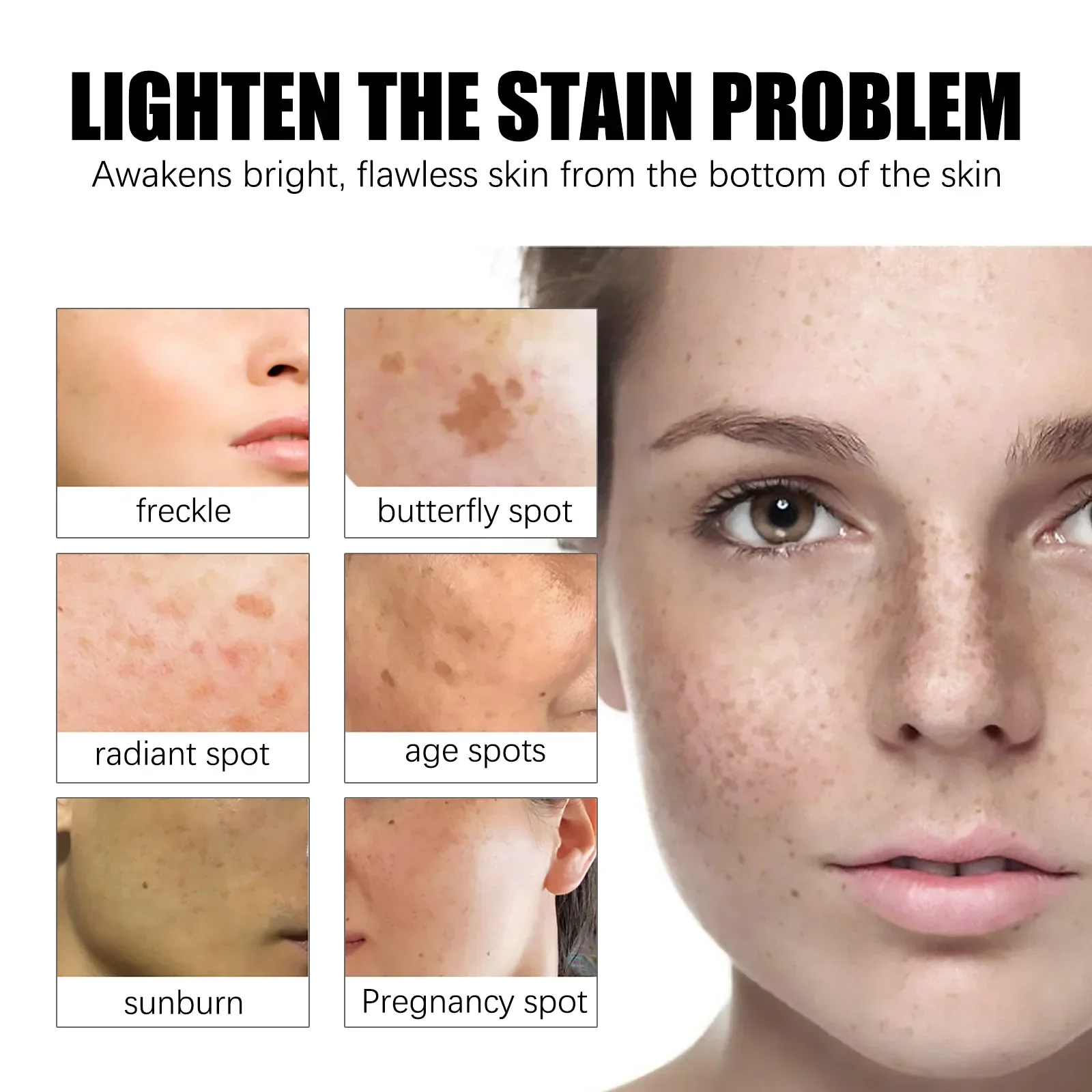 Face Cream Remove Melasma Dark Spots Lighten Melanin Remover Moisturizing Brightening Face Smooth Skin Korean Care Product 30ML