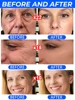 wrinkles disappear，20 years younger 3
