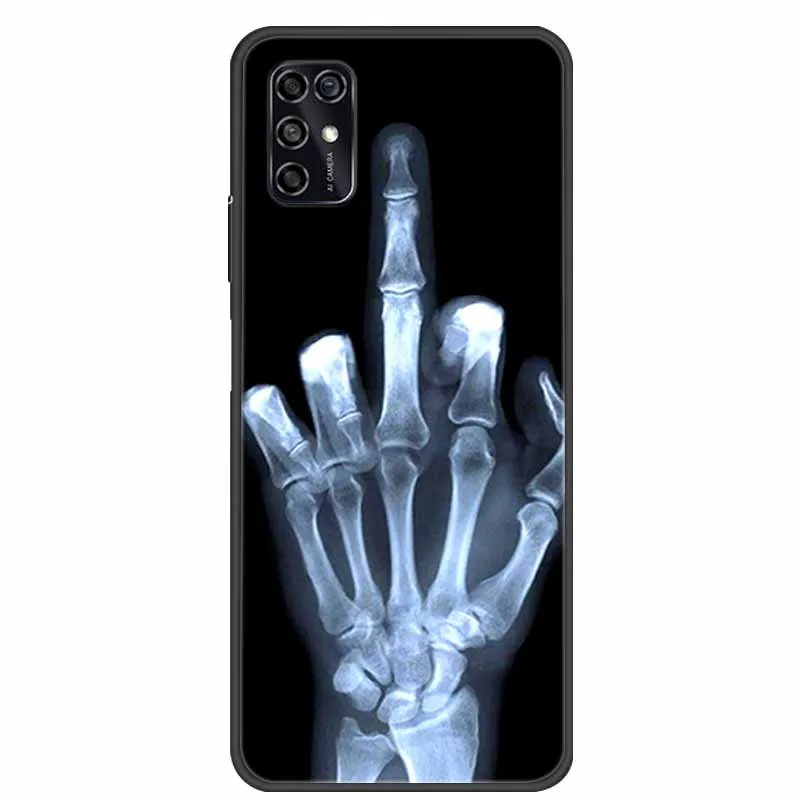 Black Silicon TPU Soft Phone Cover with Cartoon Design