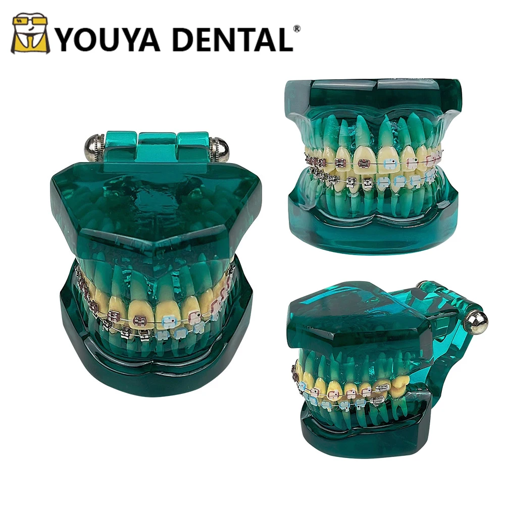 dental-orthodontic-model-with-metal-ceramic-self-locking-for-orthodontic-treatment-practice-training-studying-teaching-model