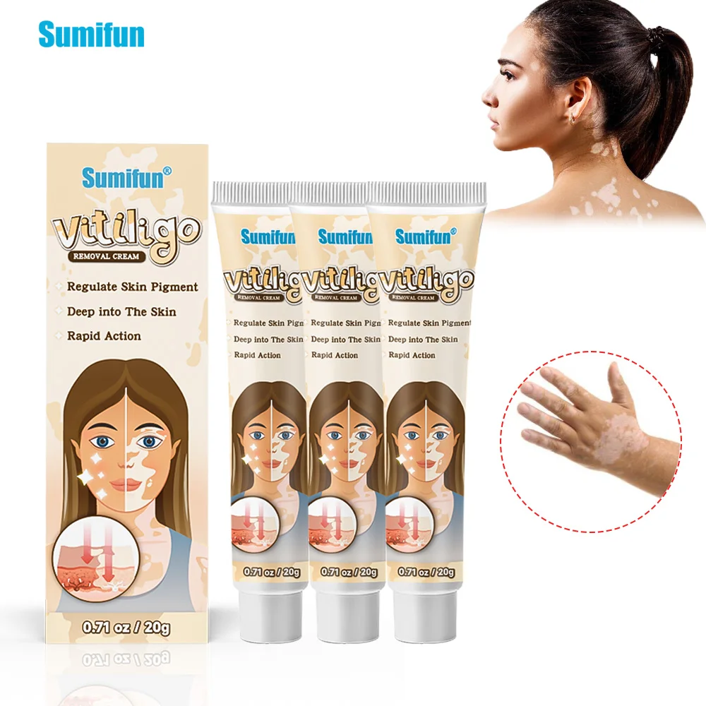 

1/2/3Pcs Sumifun Vitiligo Antibacterial Cream Remove White Spot Whitening Ointment Leukoplakia Melanin Skin Care Herbs Plaster