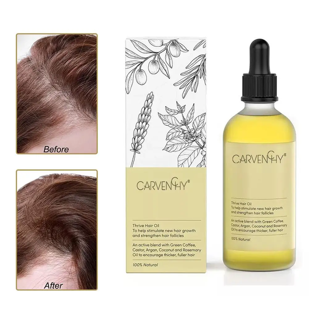 Description Picture 3 of itemFast Spray Products Prevent Hair Loss Essential Oil Fast Growing Scalp Treatment Beauty Health For Men Women