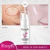 Pore ​​Shrinking Essence Face Repair Essential Oil Repairing Shrinking Pores Whitening Moisturizing Remove  Blackheads Face Care 2